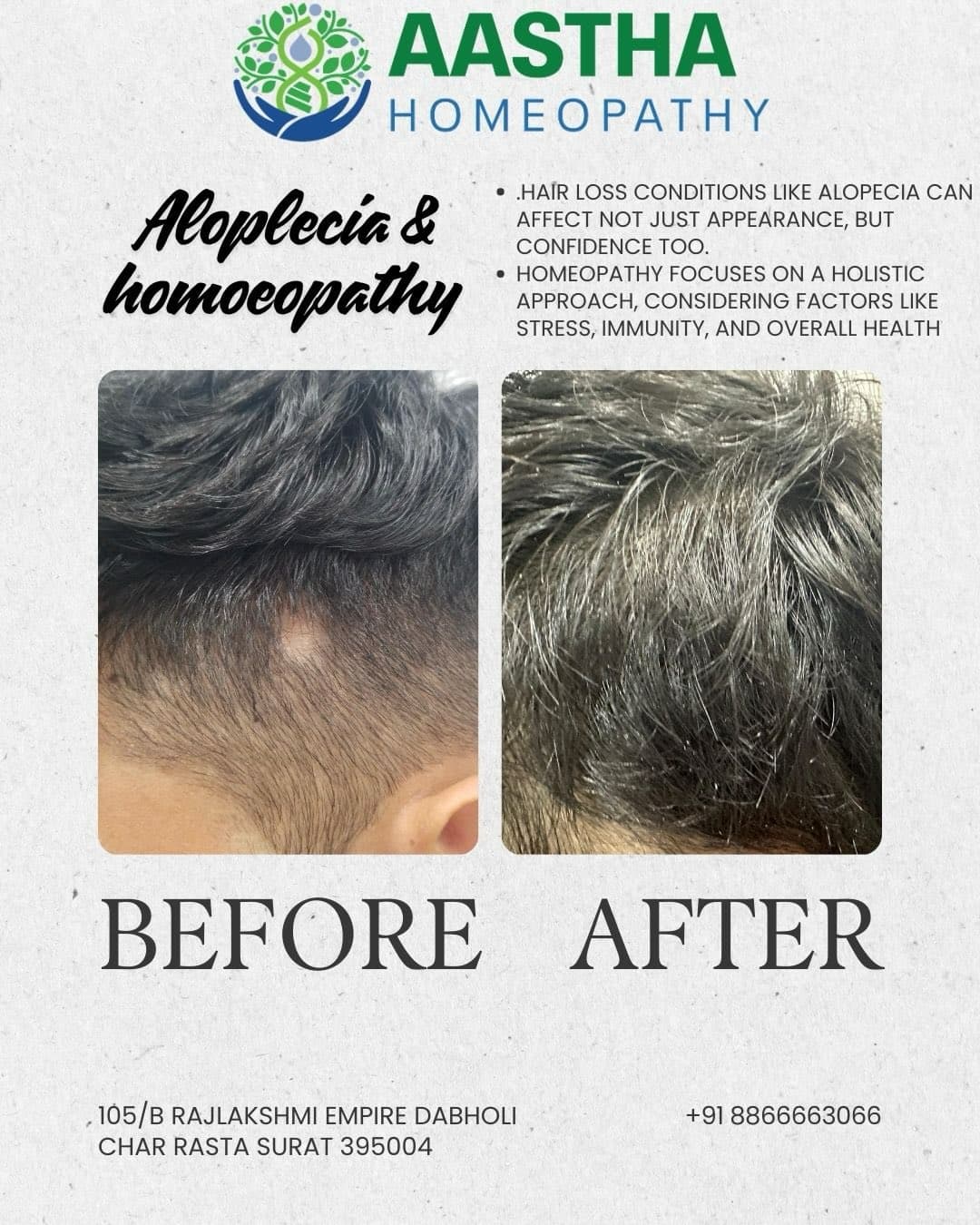 Patient result: Alopecia · 6 months