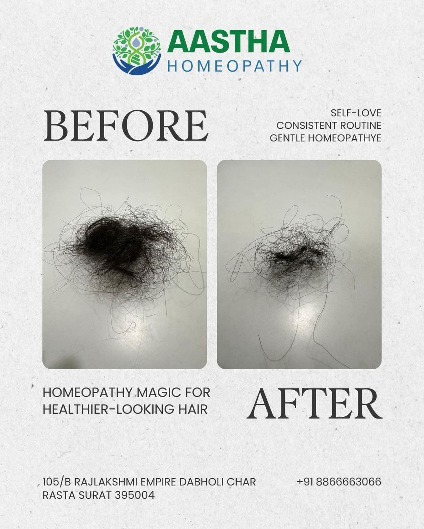 Patient result: Hair loss · 5 months