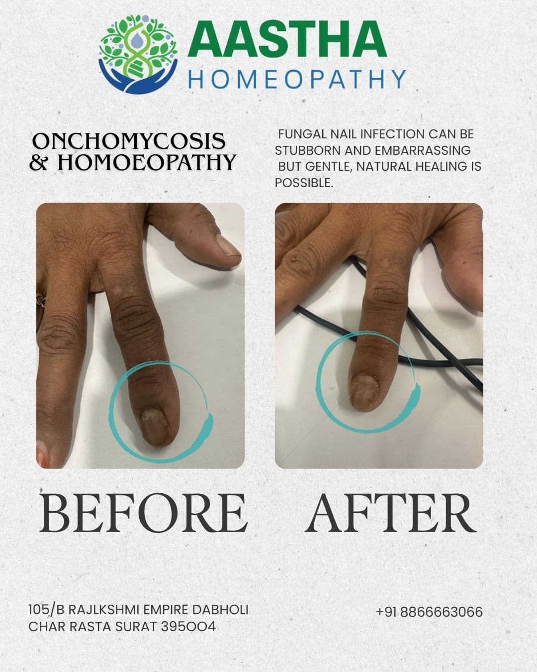 Patient result flyer: Before and After comparison