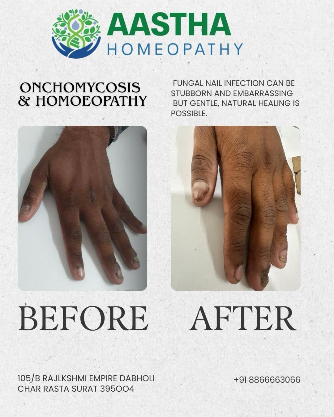 Patient result: Skin infection · 6 weeks