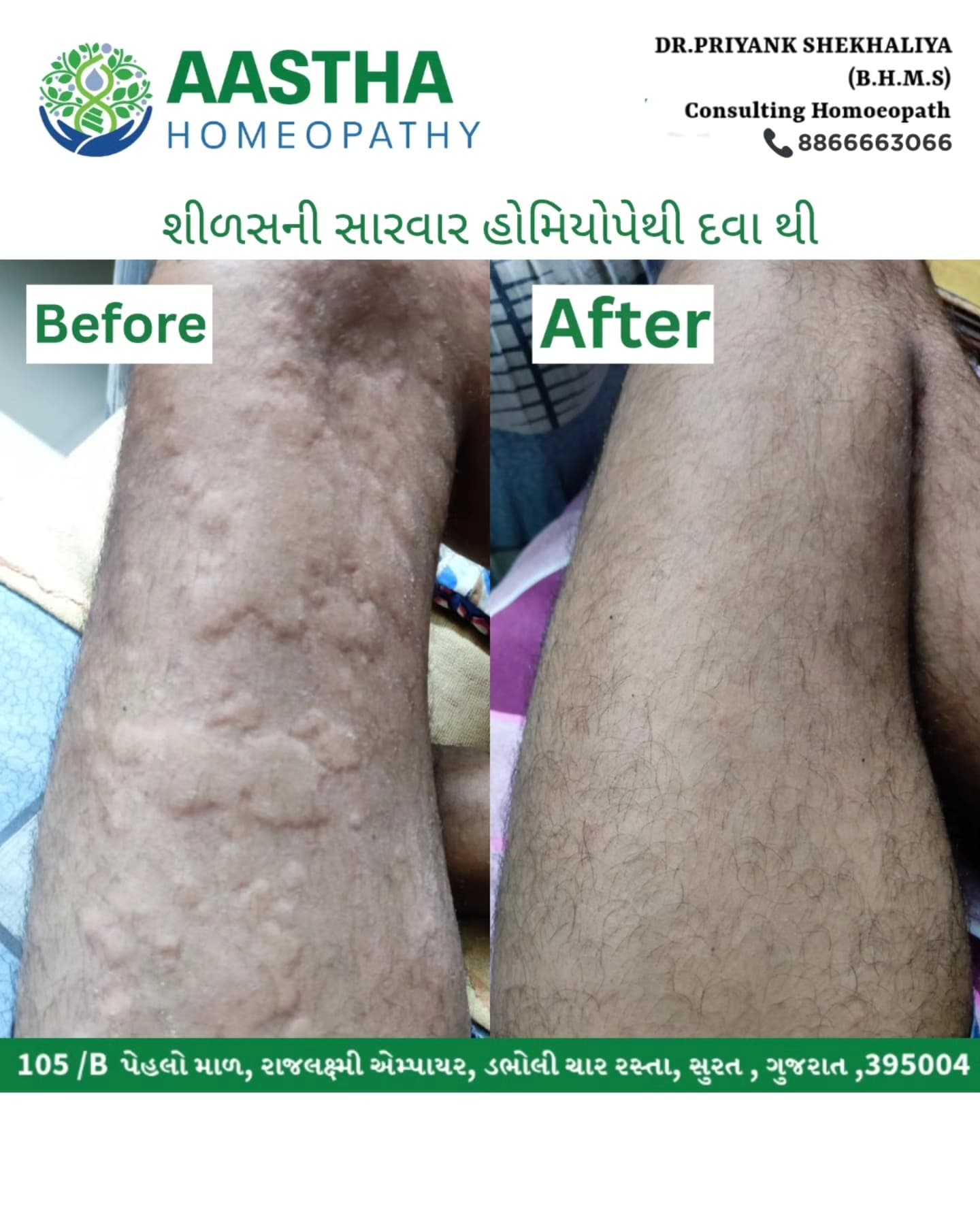 Patient result: Urticaria · 2 months